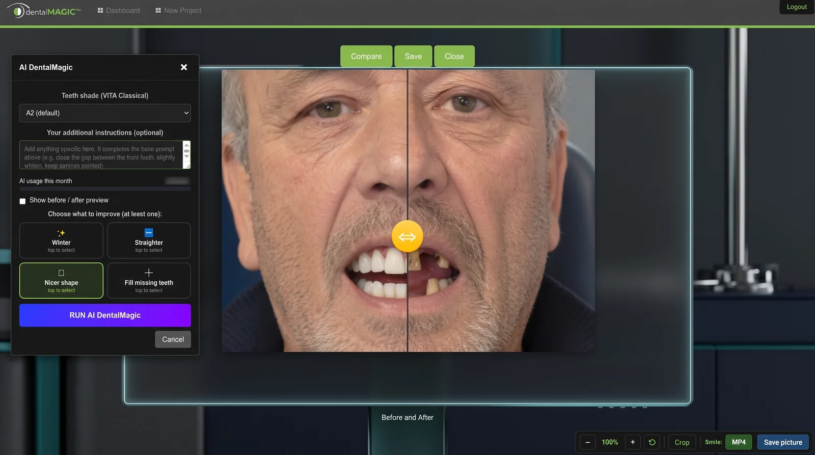 The AI DentalMagic window open on the left — VITA Classical shade set to A2, a free-text instruction field, the monthly usage counter, the before and after preview checkbox, and the four improvements with Nicer shape selected — beside the patient's photograph split down the middle by the orange comparison handle.