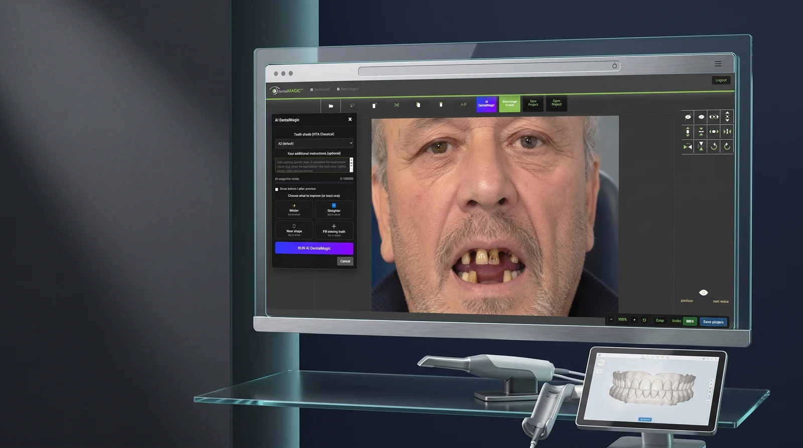 DentalMagic open on a consulting-room screen beside an intraoral scanner, showing a patient photograph loaded in the workspace with the AI panel open.
