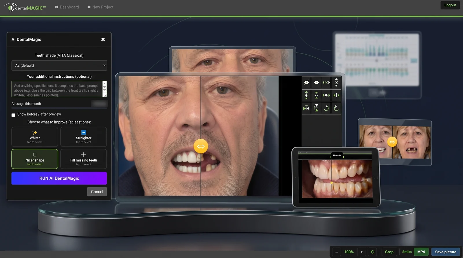 The DentalMagic workspace with the transform pad open on the right: enlarge, shrink, flip and rotate controls for the selected layer, beside the A|B comparison of the patient's photograph split by the orange handle.
