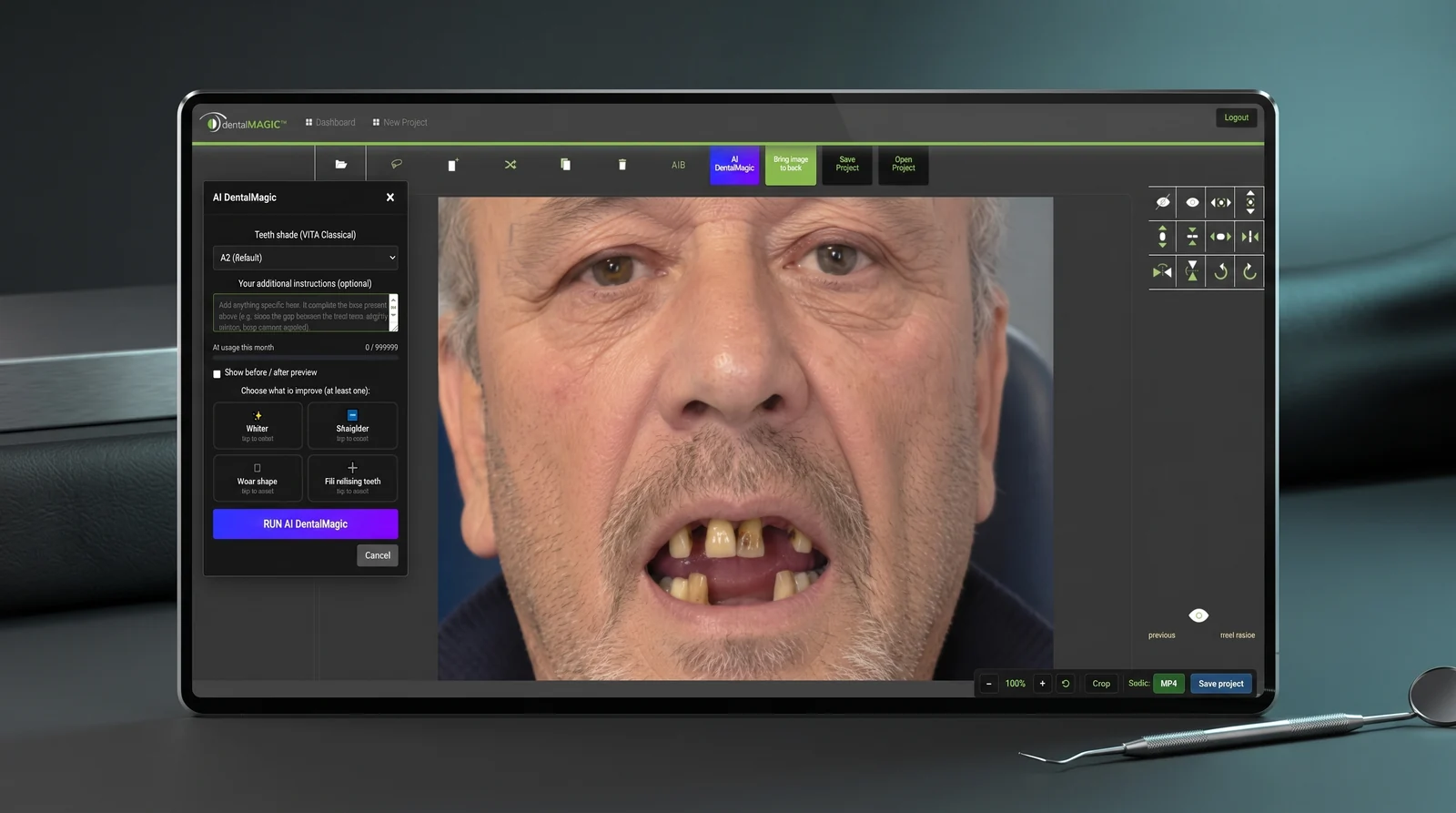 The DentalMagic workspace open on a tablet: the eleven-tool toolbar across the top, the AI DentalMagic panel on the left with the VITA shade list and the four improvements, the transform pad on the right, and the zoom, crop, MP4 and save controls along the bottom.